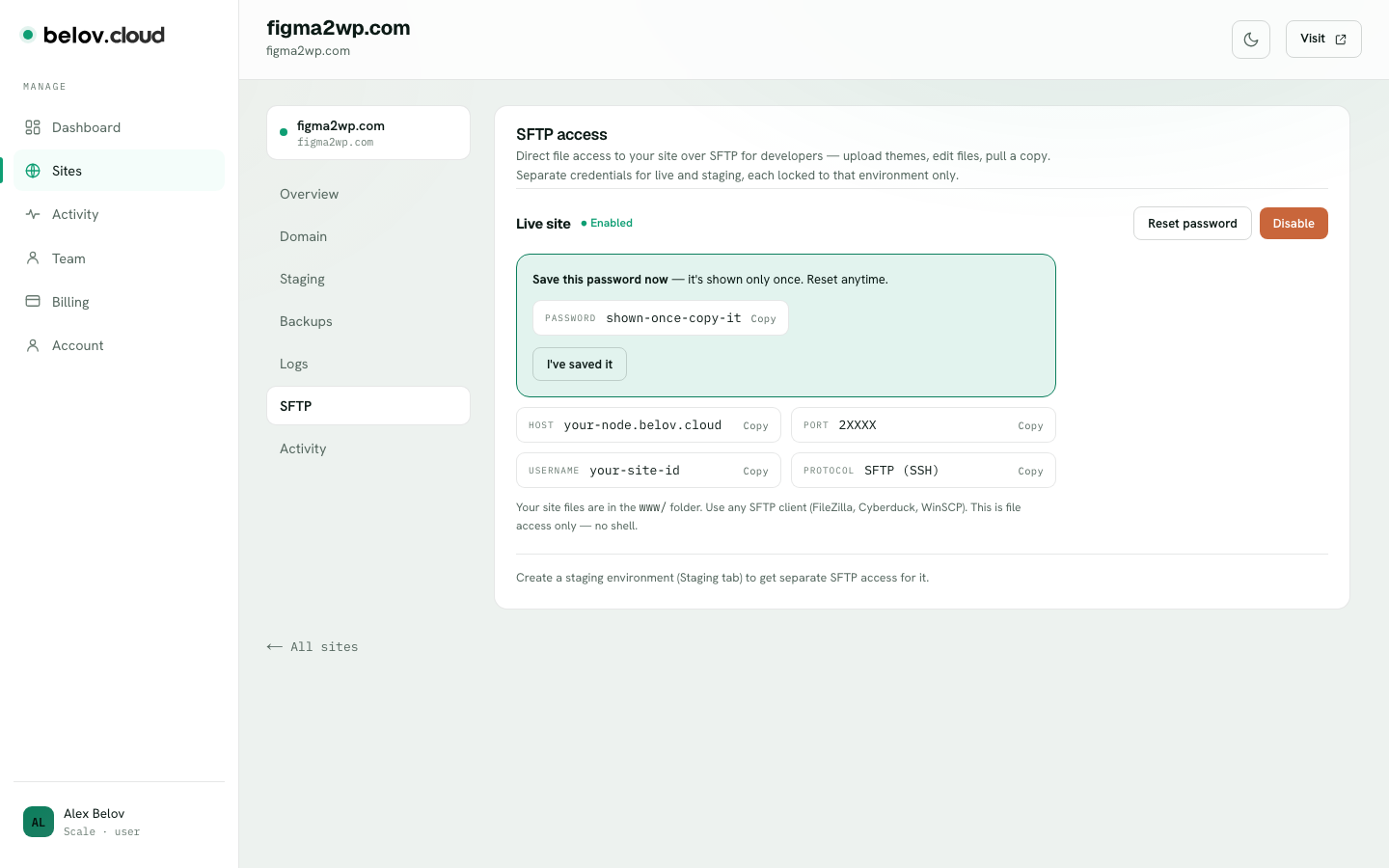The SFTP tab on a site, with a per-environment Enable button and the connection details — host, port, and username